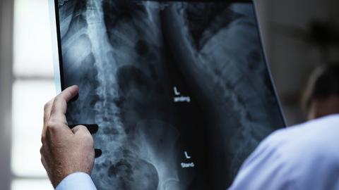 Жінка зламала ребро під час нападу кашлю (фото)