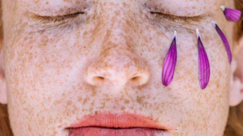 Налегайте на эти продукты: врач рассказала, как предотвратить гиперпигментацию кожи