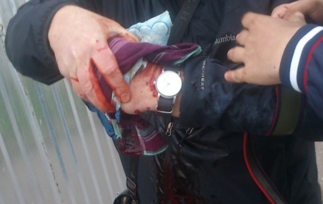 Взрыв на траурном митинге в Одессе: один человек госпитализирован