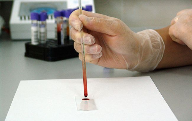 Вчені назвали групу крові, найбільш вразливу до раку