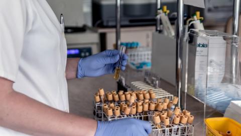 Революционные изменения: как теперь будут лечить гепатит в Украине