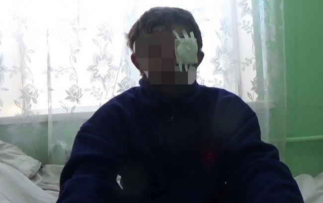 Узятий у полон в Авдіївці бойовик дав свідчення СБУ