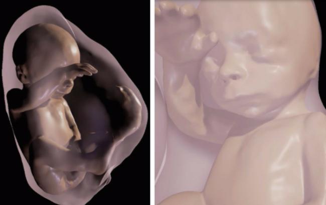 Будущий ребенок в 3D: родители смогут увидеть малыша еще до рождения