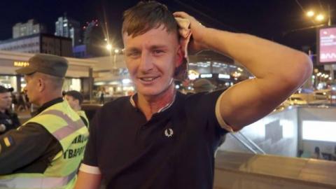 Напад на фанатів "Ліверпуля": постраждалі відмовилися від заяв до поліції