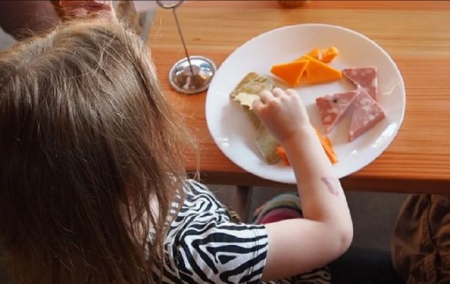 Нутриціолог пояснив, чи можна дитину із зайвою вагою обмежувати в їжі
