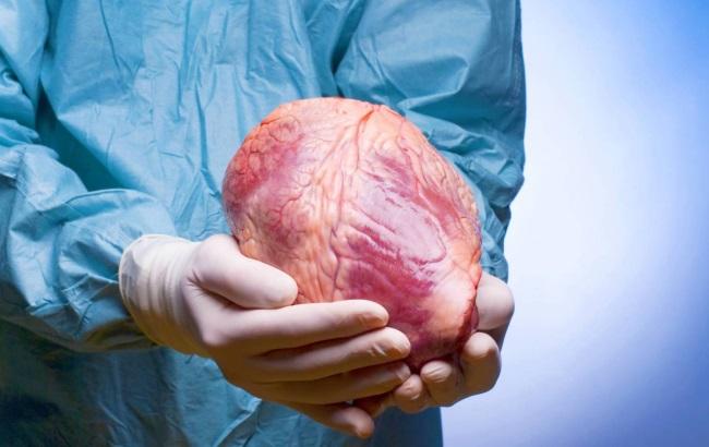 В "ДНР" хотят привлечь "миллиардные инвестиции", торгуя органами