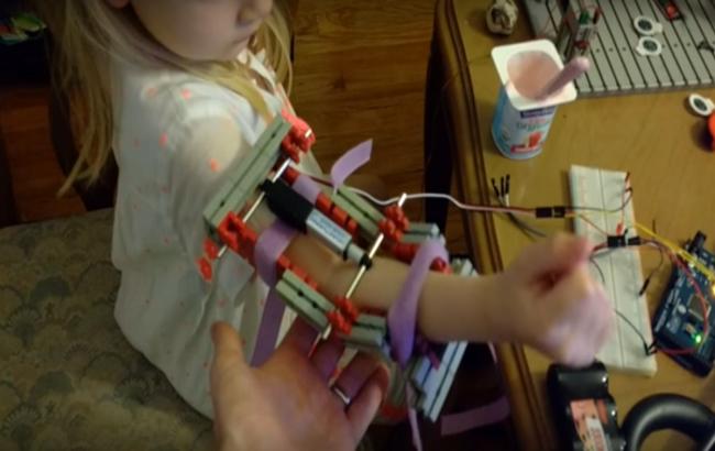 Программист напечатал на 3D-принтере реабилитационный бионический ортез для своей дочери