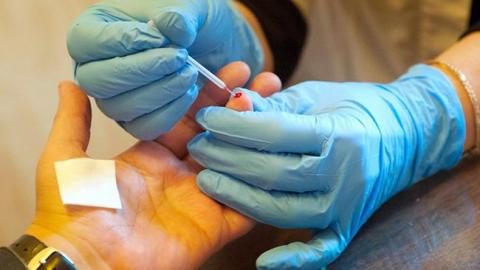 Гепатит А у Миколаєві: число госпіталізованих зросло