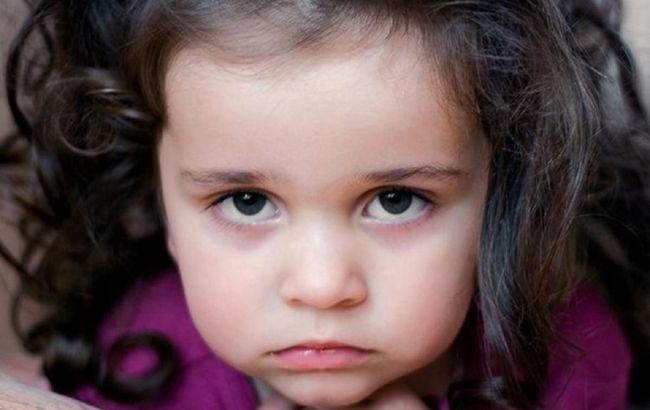 От храпа до аллергии. Врач назвала причины темных кругов под глазами у детей