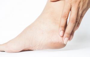 Більше ніяких тріщин: як вилікувати п&rsquo;яти вдома та не проґавити небезпечний симптом