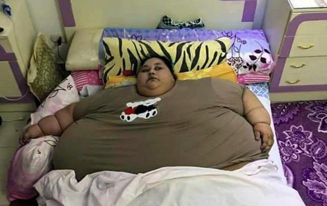 Найважча в світі жінка скинула 100 кг за 20 днів