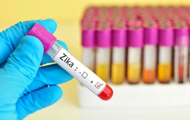 У США зафіксовано першу смерть зараженого вірусом Зіку